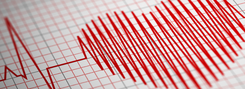 Eletrocardiograma – ECG