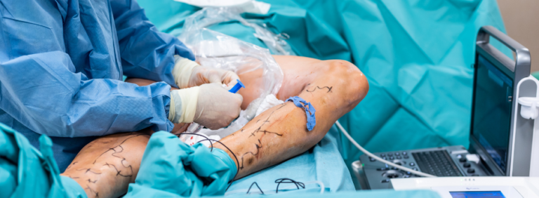 Angiologia e Cirurgia Vascular