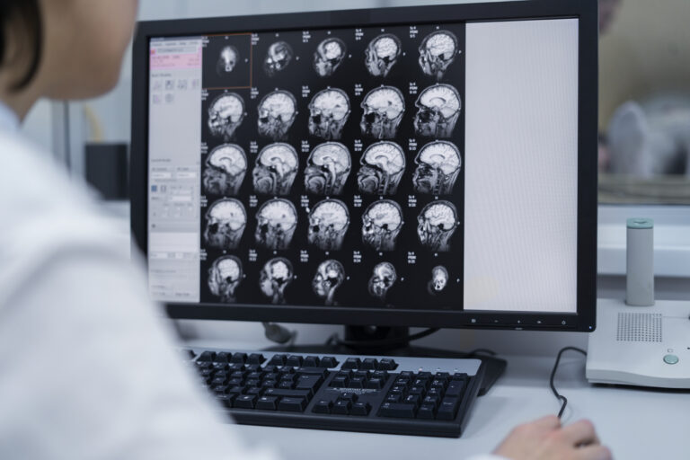 Neurorradiologia
