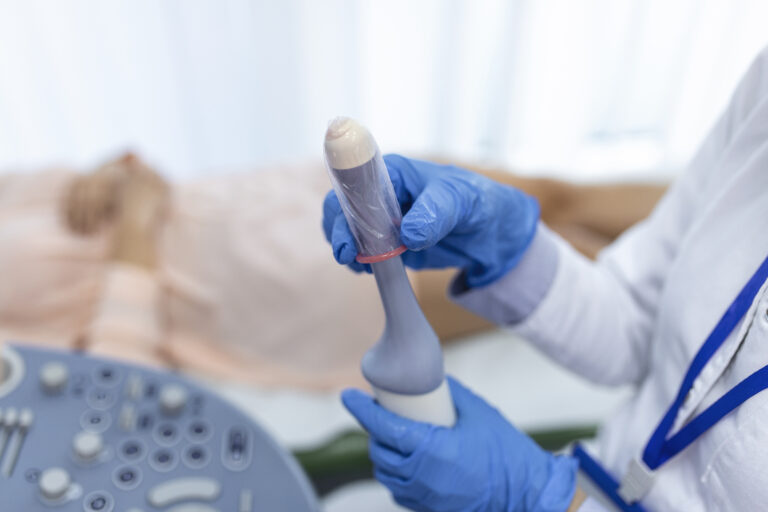 Ecodoppler Endovaginal