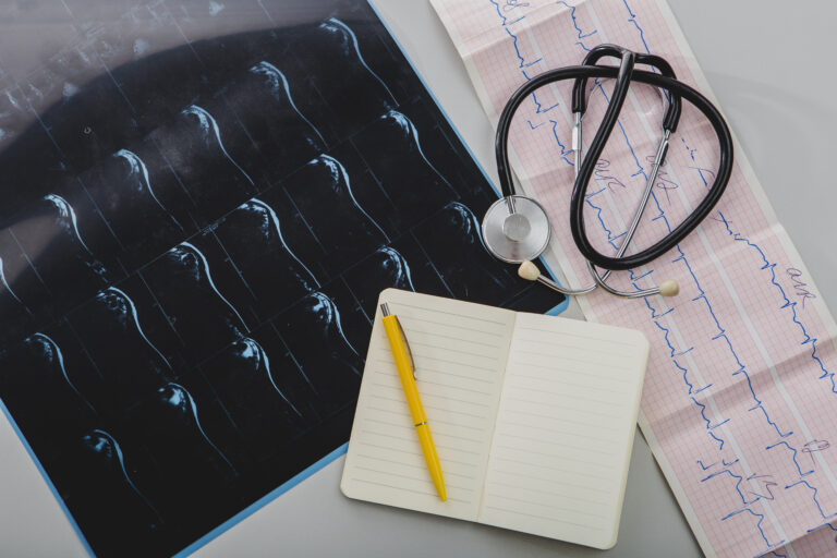 CTG (Cardiotocografia)