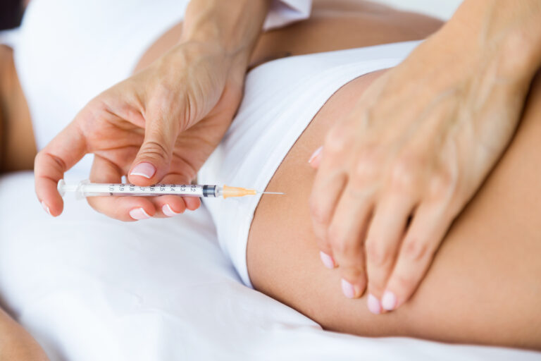 Escleroterapia