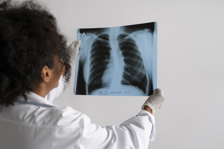 Estudo de Difusão Pulmonar (DLCO)